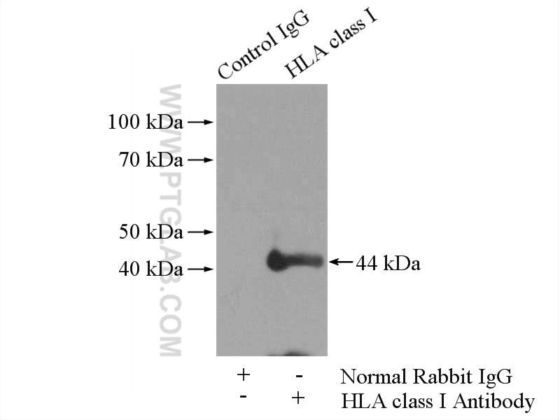 15777-1-AP;Jurkat cells