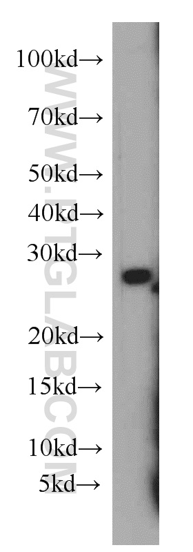 55072-1-AP;Raji cells