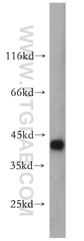 14797-1-AP;HeLa cell