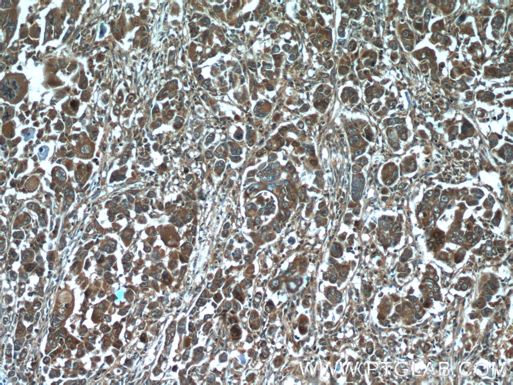 13533-1-AP;human liver cancer tissue