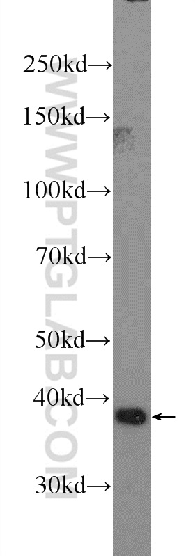 14817-1-AP;HepG2 cells