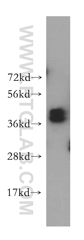 12770-1-AP;HeLa cells