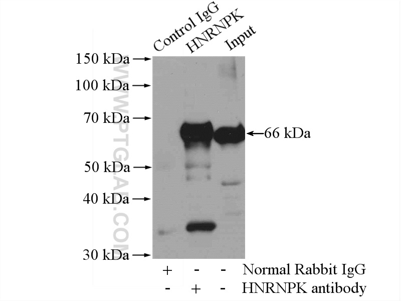 11426-1-AP;HeLa cells