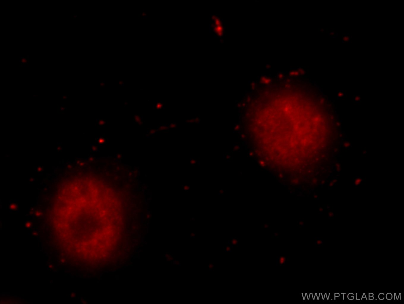 18354-1-AP;HeLa cells