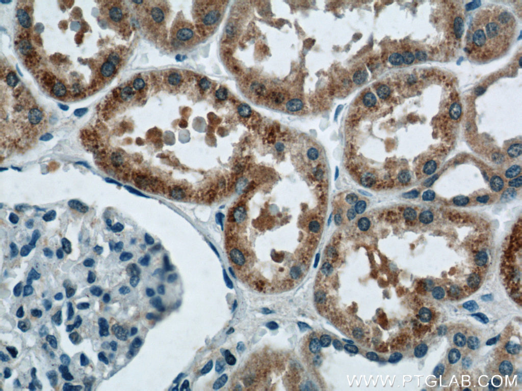 18354-1-AP;human kidney tissue