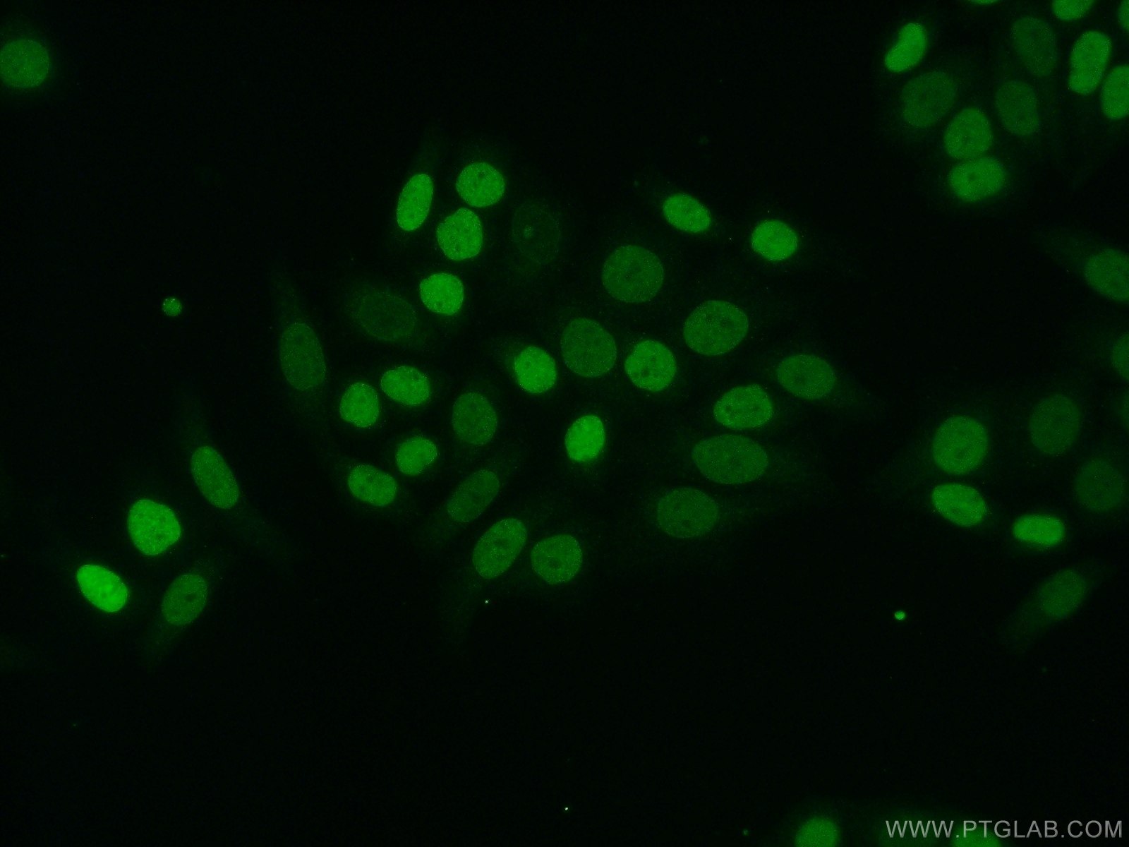 14599-1-AP;HeLa cells