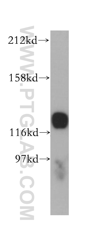 14599-1-AP;Jurkat cell