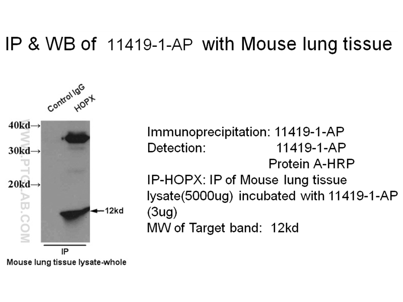 11419-1-AP;Mouse lung