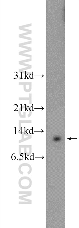 11419-1-AP;mouse lung tissue