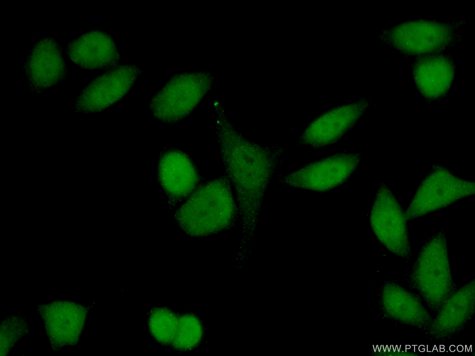 24556-1-AP;HeLa cells