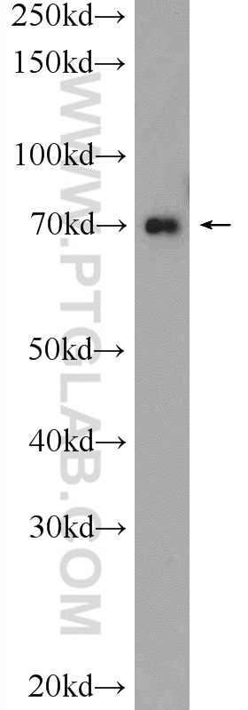 24556-1-AP;HeLa cells