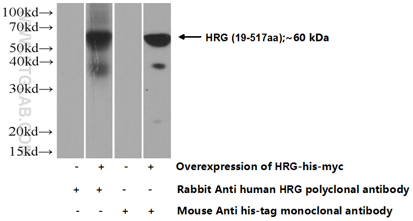 26252-1-AP;Transfected HEK-293 cells