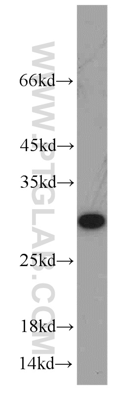 10648-1-AP;HeLa cells