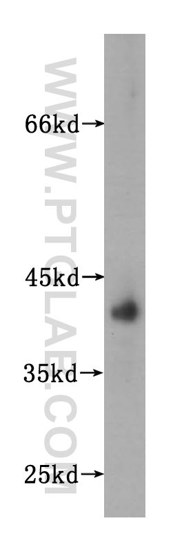 10978-1-AP;human liver tissue