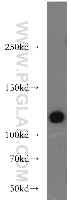 21206-1-AP;L02 cells