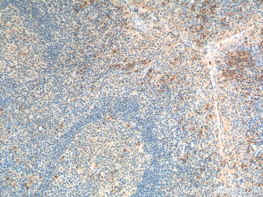 55302-1-AP;human tonsillitis tissue