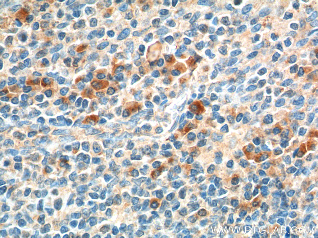 55302-1-AP;human tonsillitis tissue