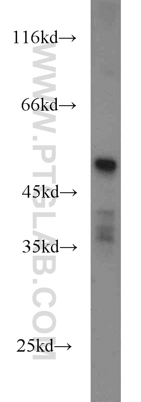 14095-1-AP;human placenta tissue