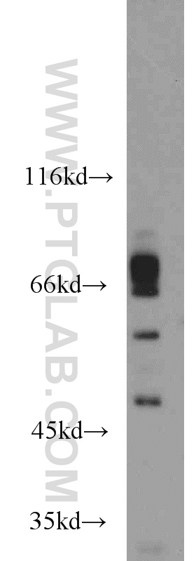 14922-1-AP;Jurkat cell