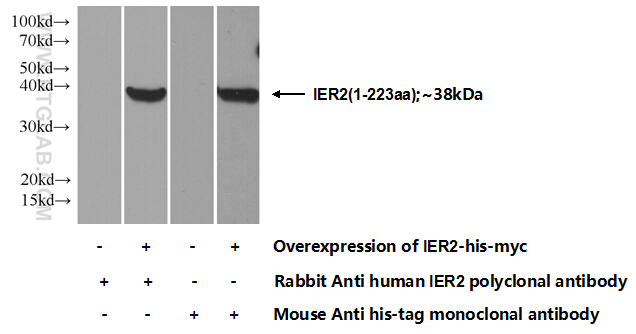 23849-1-AP;Transfected HEK-293 cells