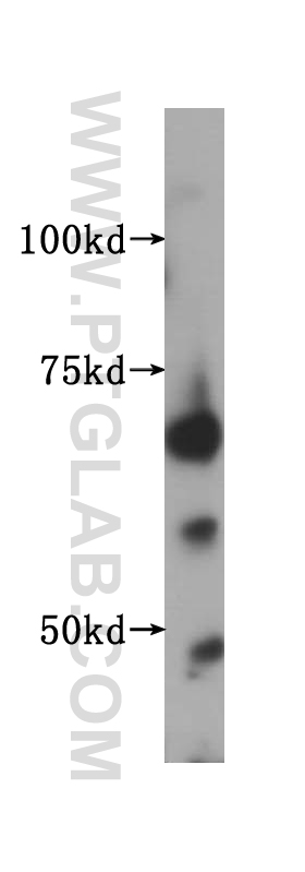 11601-1-AP;human kidney tissue