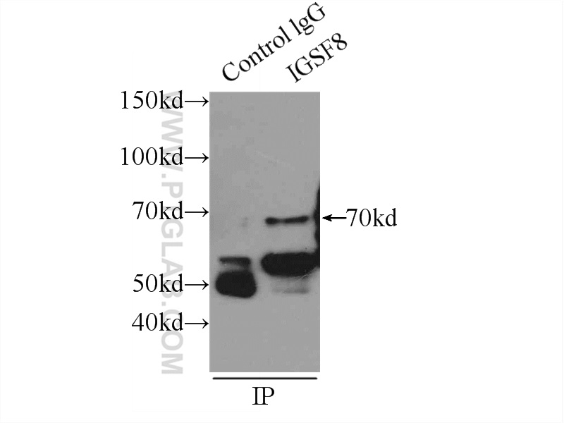 14387-1-AP;mouse brain tissue