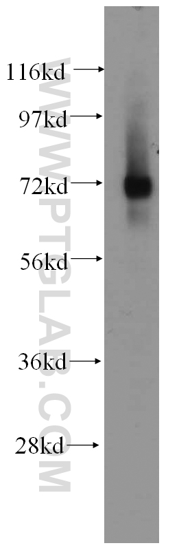 14387-1-AP;K-562 cell