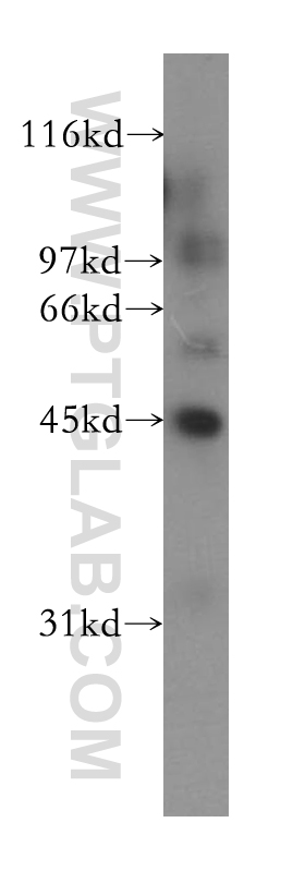 13388-1-AP;human kidney tissue