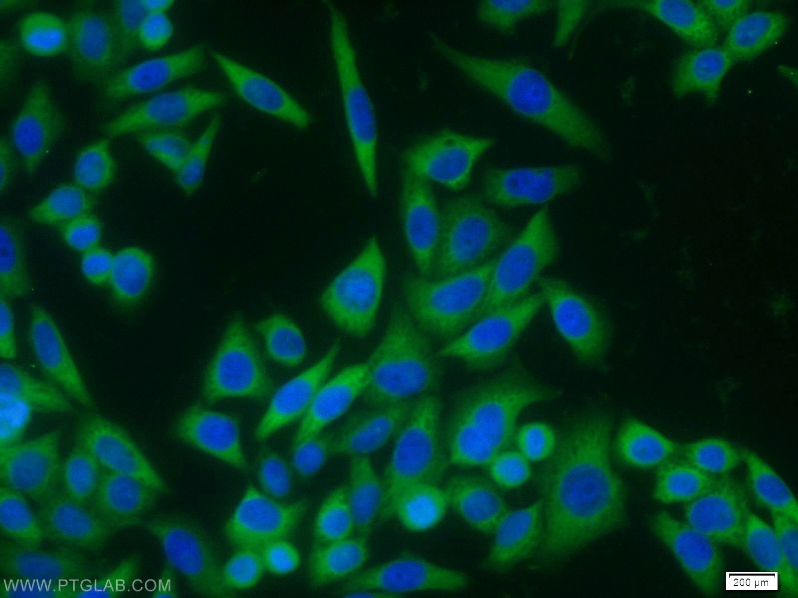 10663-1-AP;HeLa cells