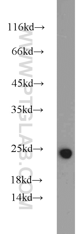 10663-1-AP;HeLa cells