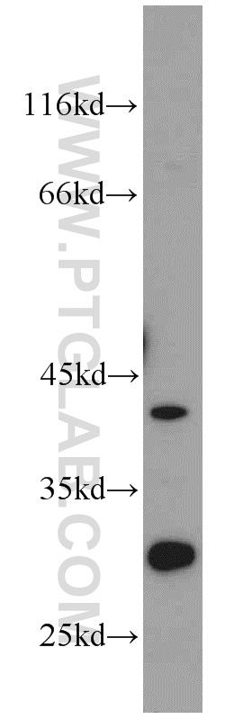 11920-1-AP;mouse brain tissue