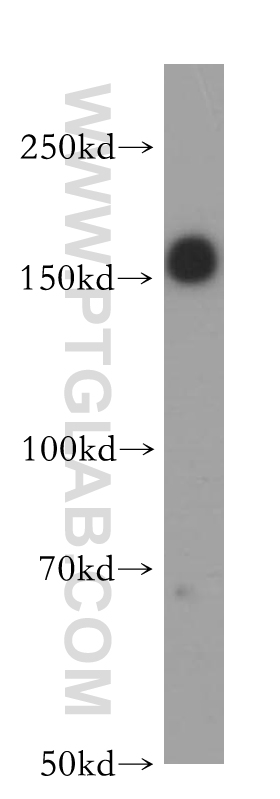 17509-1-AP;A549 cells