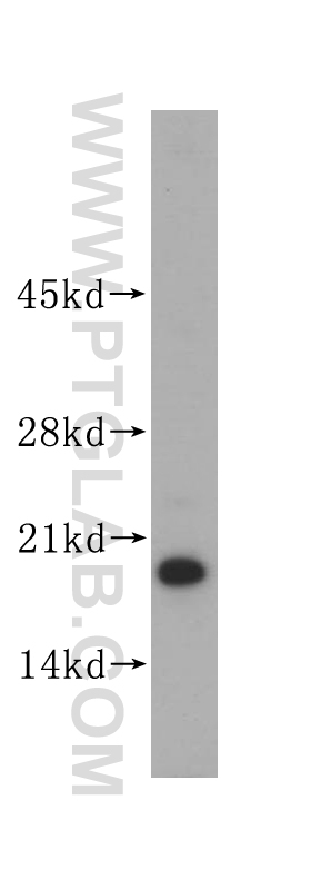 14812-1-AP;mouse heart tissue