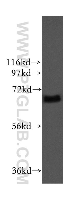 11731-1-AP;mouse testis tissue