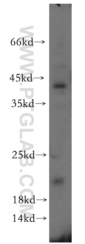 12300-1-AP;PC-3 cells