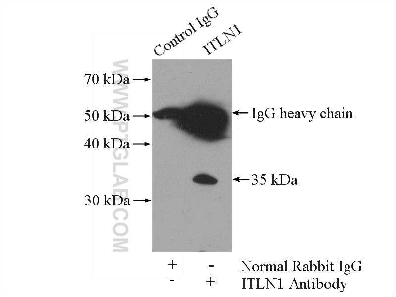 11770-1-AP;mouse appendix tissue