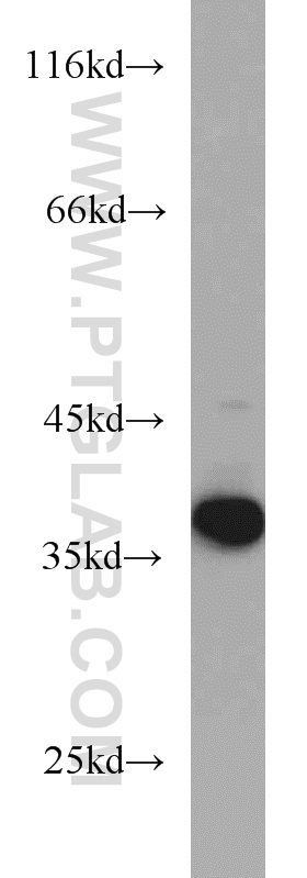 11770-1-AP;mouse colon tissue