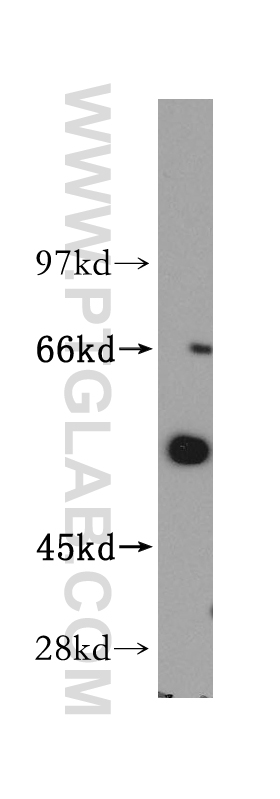 14270-1-AP;mouse brain tissue