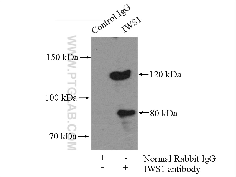 16943-1-AP;mouse brain tissue