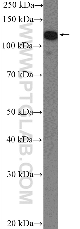 16943-1-AP;HeLa cells