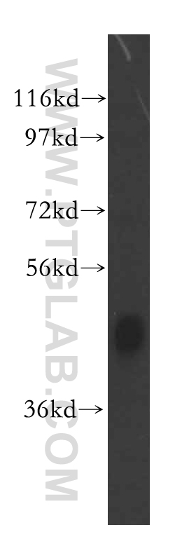 16476-1-AP;mouse liver tissue