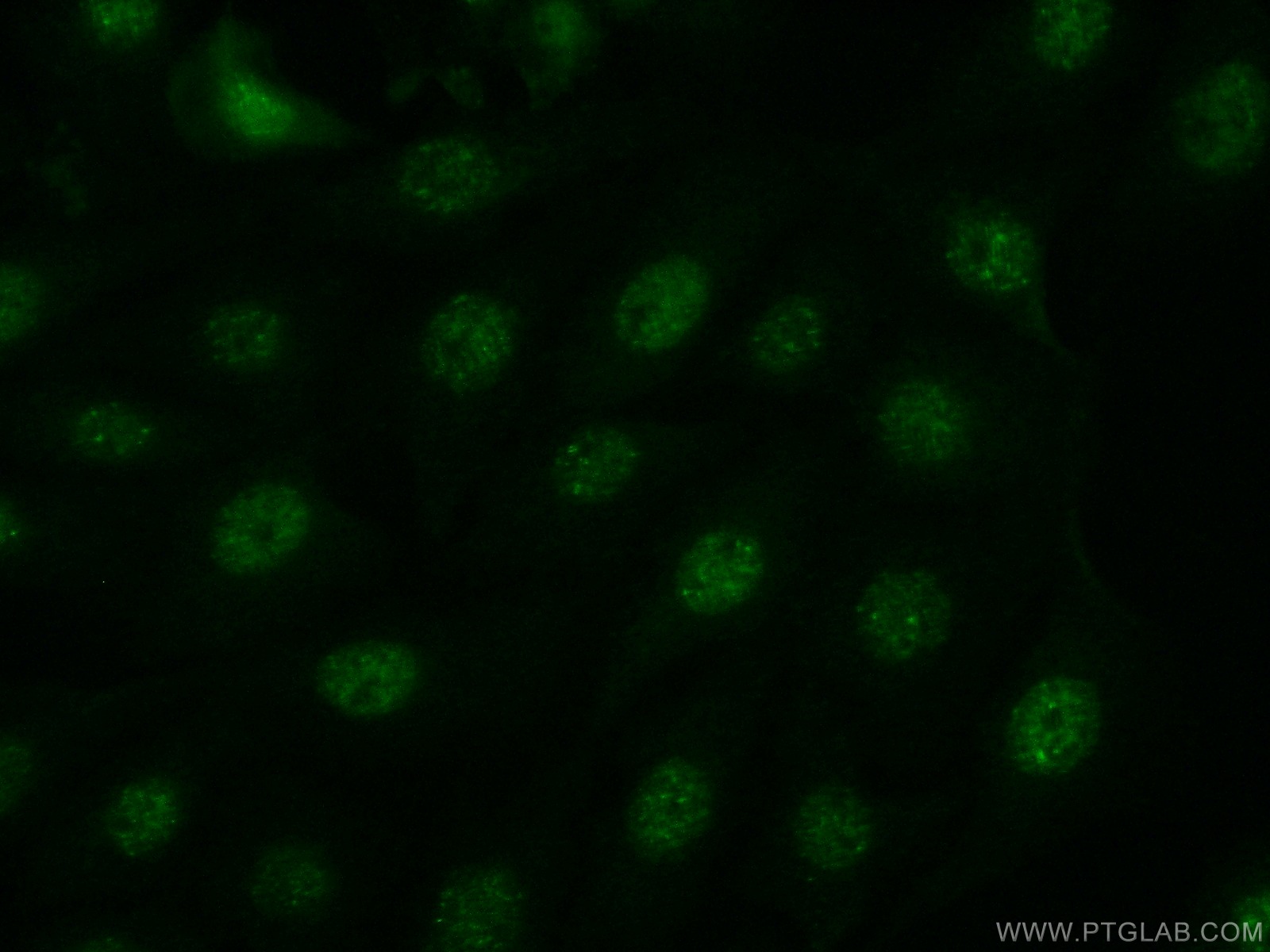 51151-1-AP;SH-SY5Y cells