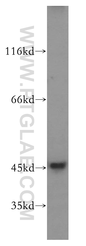 51151-1-AP;SH-SY5Y cell