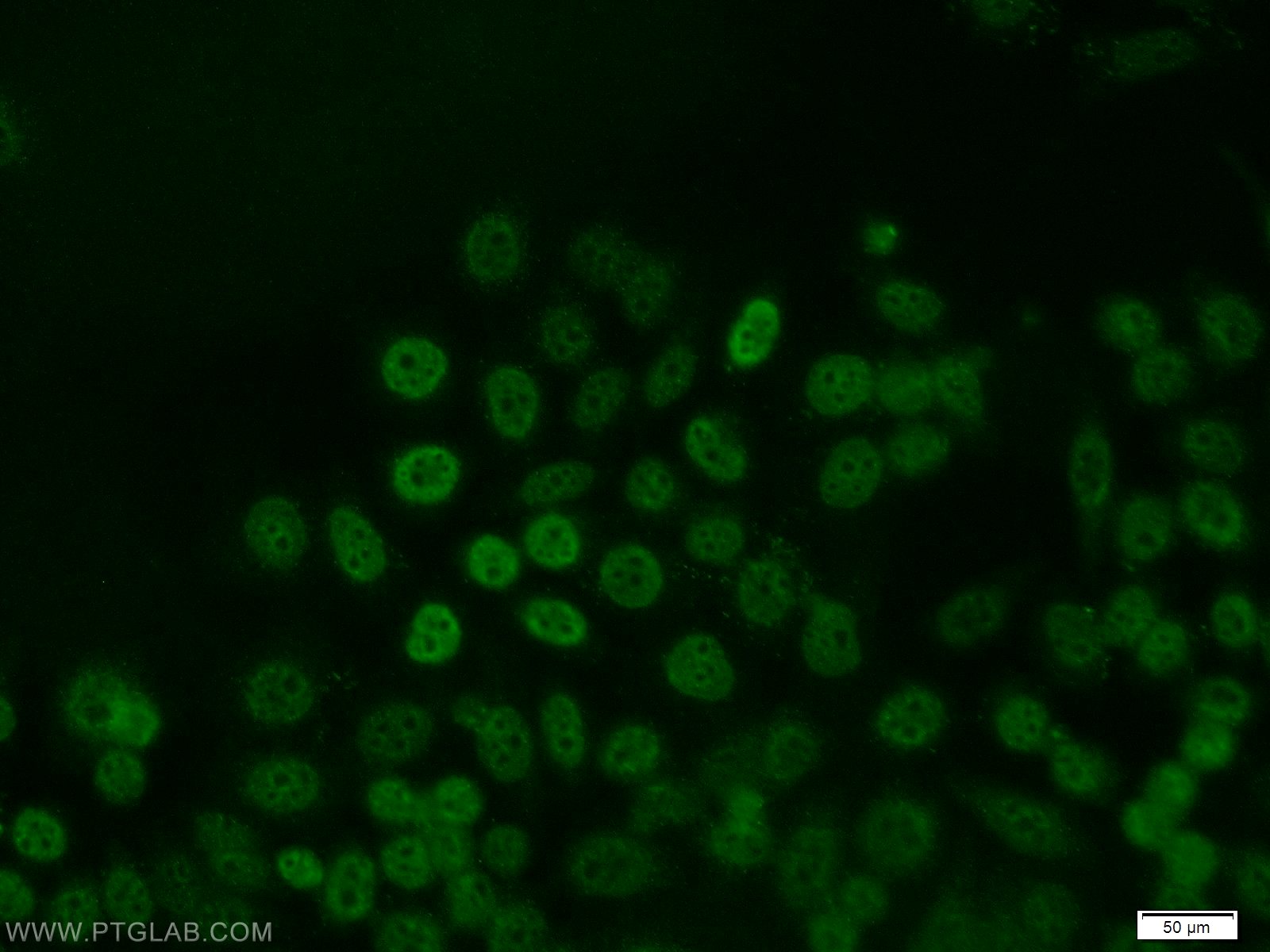 10486-1-AP;MCF-7 cells