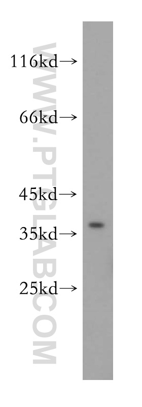 17890-1-AP;HepG2 cell