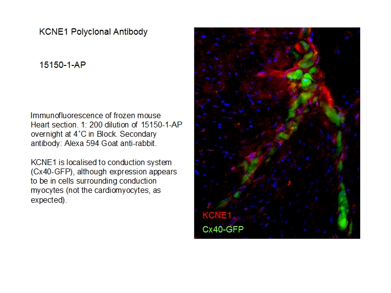 15150-1-AP;mouse heart tissue