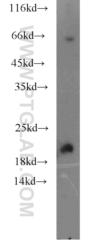 15150-1-AP;mouse heart tissue