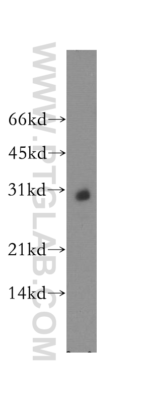 13748-1-AP;mouse brain tissue