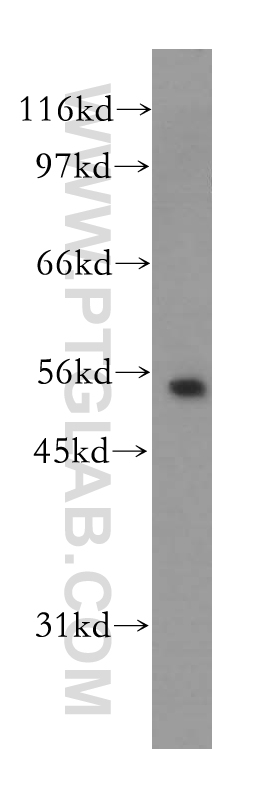 12696-1-AP;human brain tissue