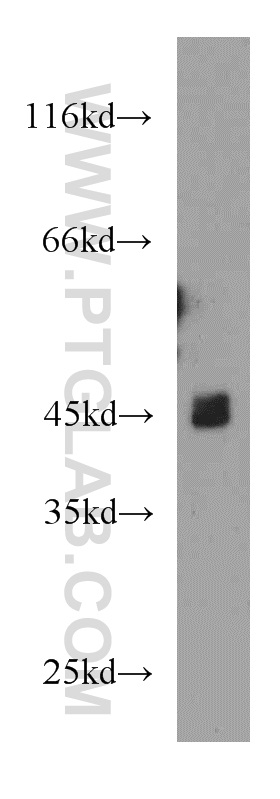 21647-1-AP;mouse brain tissue